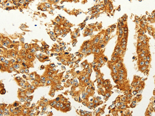 FZD6 Polyclonal Antibody Store at -20°C