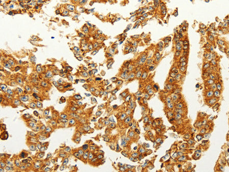 FZD6 Polyclonal Antibody Store at -20°C