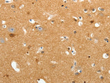TNR Polyclonal Antibody