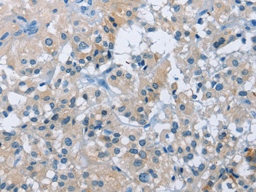 BTN2A2 Polyclonal Antibody