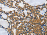 PIAS2 Polyclonal Antibody