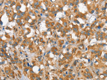 CSMD1 Polyclonal Antibody Store at -20°C