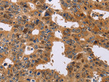 NIF3L1 Polyclonal Antibody Store at -20°C