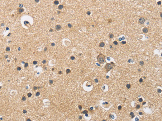 CKMT2 Polyclonal Antibody Store at -20°C