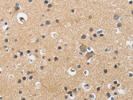 CKMT2 Polyclonal Antibody Store at -20°C