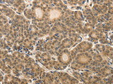 MAP1A Polyclonal Antibody