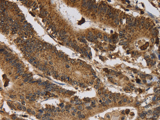 ITPR3 Polyclonal Antibody Store at -20°C