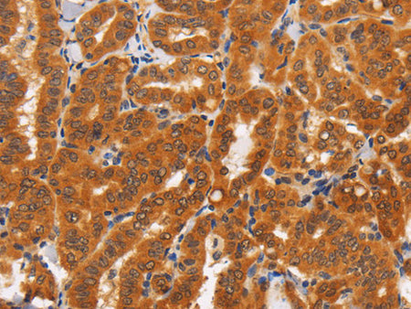 TNFRSF8 Polyclonal Antibody Store at -20°C