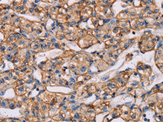 ARAP1 Polyclonal Antibody Store at -20°C