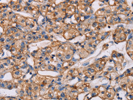 ARAP1 Polyclonal Antibody Store at -20°C