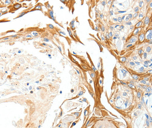 PLAT Polyclonal Antibody
