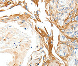 PLAT Polyclonal Antibody