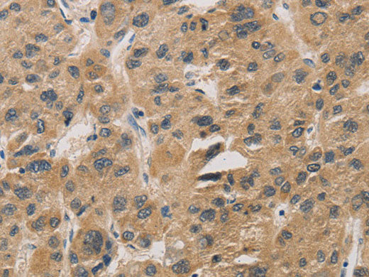 DDIT4 Polyclonal Antibody Store at -20°C