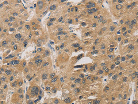 DDIT4 Polyclonal Antibody Store at -20°C