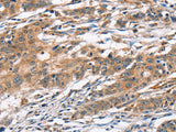 CAMK4 Polyclonal Antibody Store at -20°C