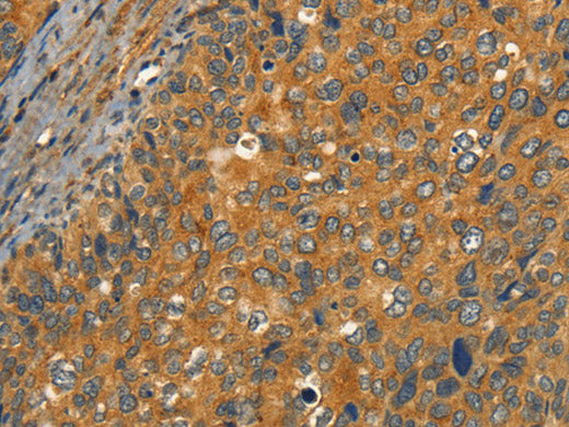 CIB1 Polyclonal Antibody Store at -20°C