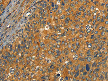 CIB1 Polyclonal Antibody Store at -20°C