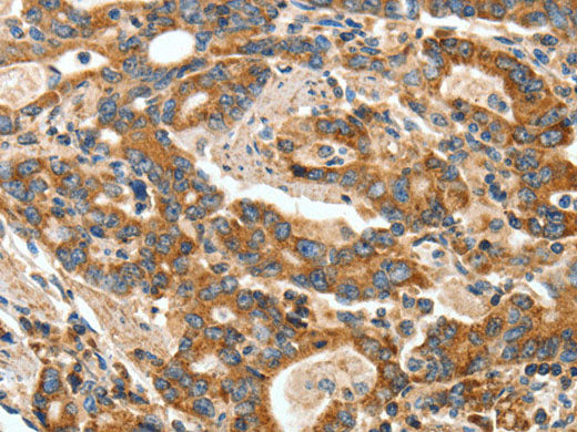 ANGPTL1 Polyclonal Antibody Store at -20°C - MSE Supplies LLC