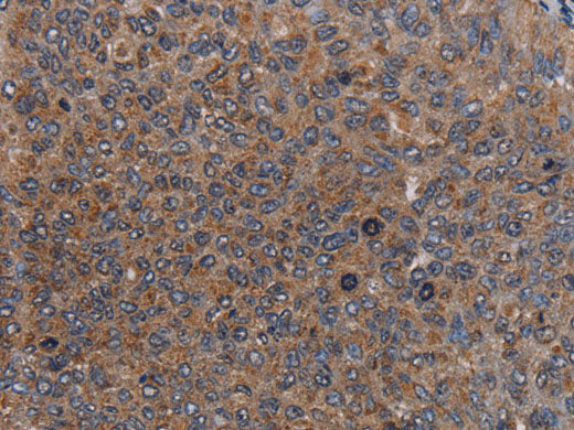 LIPE Polyclonal Antibody Store at -20°C