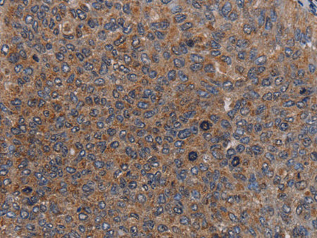 LIPE Polyclonal Antibody Store at -20°C