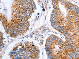 Claudin 10 Polyclonal Antibody Store at -20°C