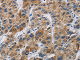 IFNGR2 Polyclonal Antibody Store at -20°C