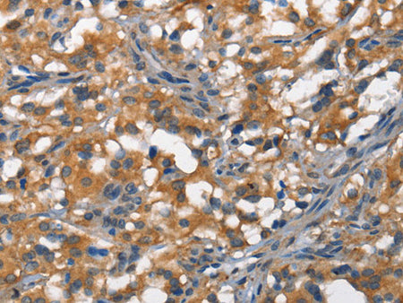 DDR2 Polyclonal Antibody Store at -20°C