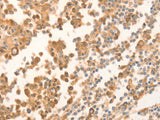 NAP1L1 Polyclonal Antibody Store at -20°C