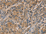 NANOS2 Polyclonal Antibody