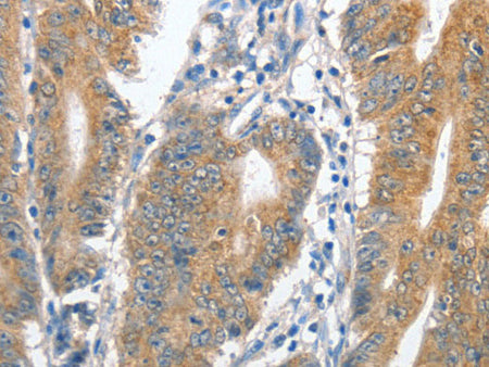 CENPC Polyclonal Antibody Store at -20°C