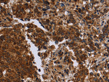FMN2 Polyclonal Antibody
