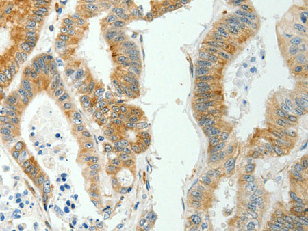 SELENOM Polyclonal Antibody Reactivity Human, Mouse