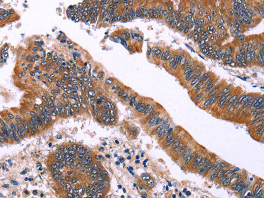 IRAK1BP1 Polyclonal Antibody Store at -20°C