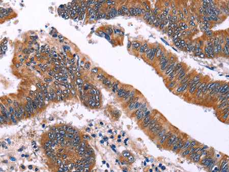 IRAK1BP1 Polyclonal Antibody Store at -20°C