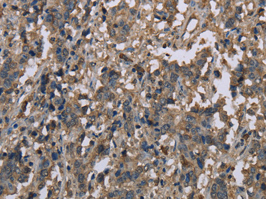 MCC Polyclonal Antibody Store at -20°C