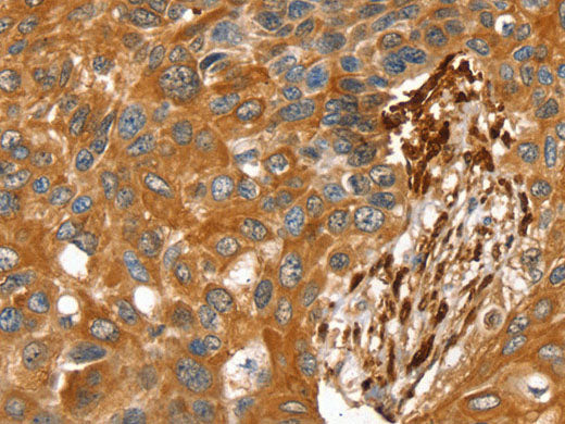TAGLN Polyclonal Antibody Store at -20°C