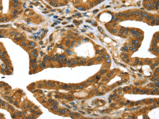 STX11 Polyclonal Antibody Store at -20°C