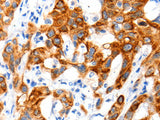 SLC2A11 Polyclonal Antibody