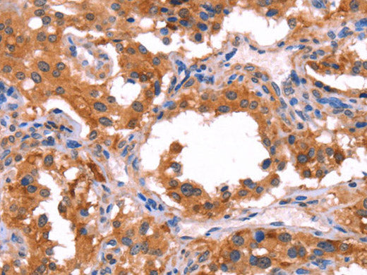 ERAS Polyclonal Antibody