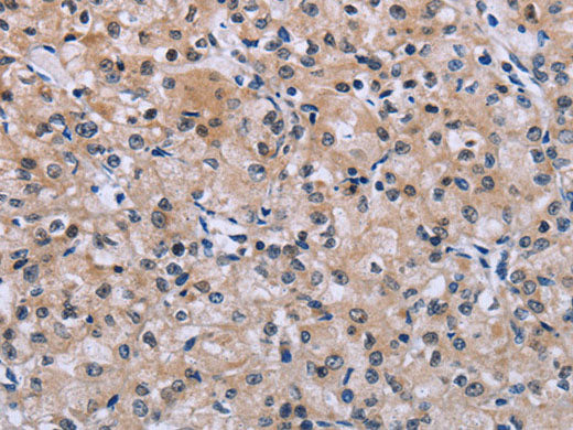 SLC1A6 Polyclonal Antibody Store at -20°C