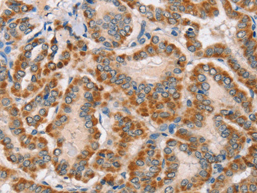 MSMB Polyclonal Antibody Store at -20°C