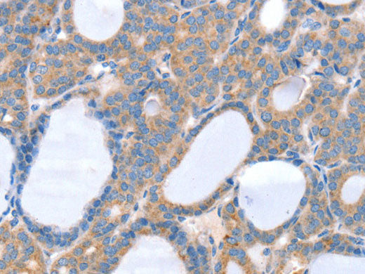 SLC25A13 Polyclonal Antibody Store at -20°C