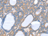 SLC25A13 Polyclonal Antibody Store at -20°C