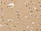 ALDH8A1 Polyclonal Antibody Store at -20°C