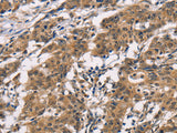 ADGRB1 Polyclonal Antibody Store at -20°C
