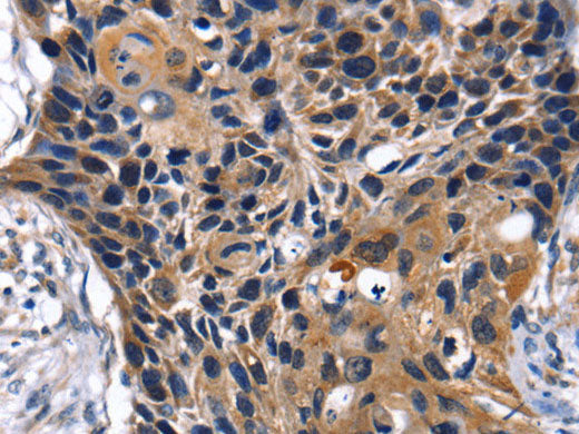 SLC2A2 Polyclonal Antibody Store at -20°C