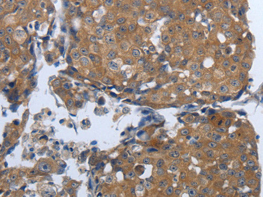 PDIA2 Polyclonal Antibody Store at -20°C