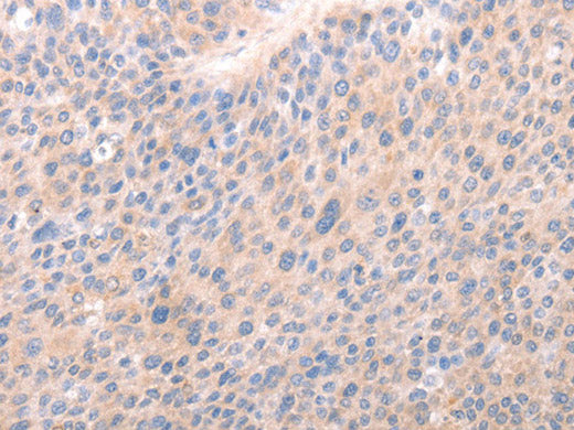 ACO1 Polyclonal Antibody Store at -20°C