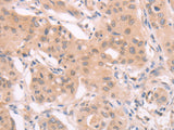 ADAM11 Polyclonal Antibody Store at -20°C