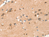CRELD1 Polyclonal Antibody Store at -20°C